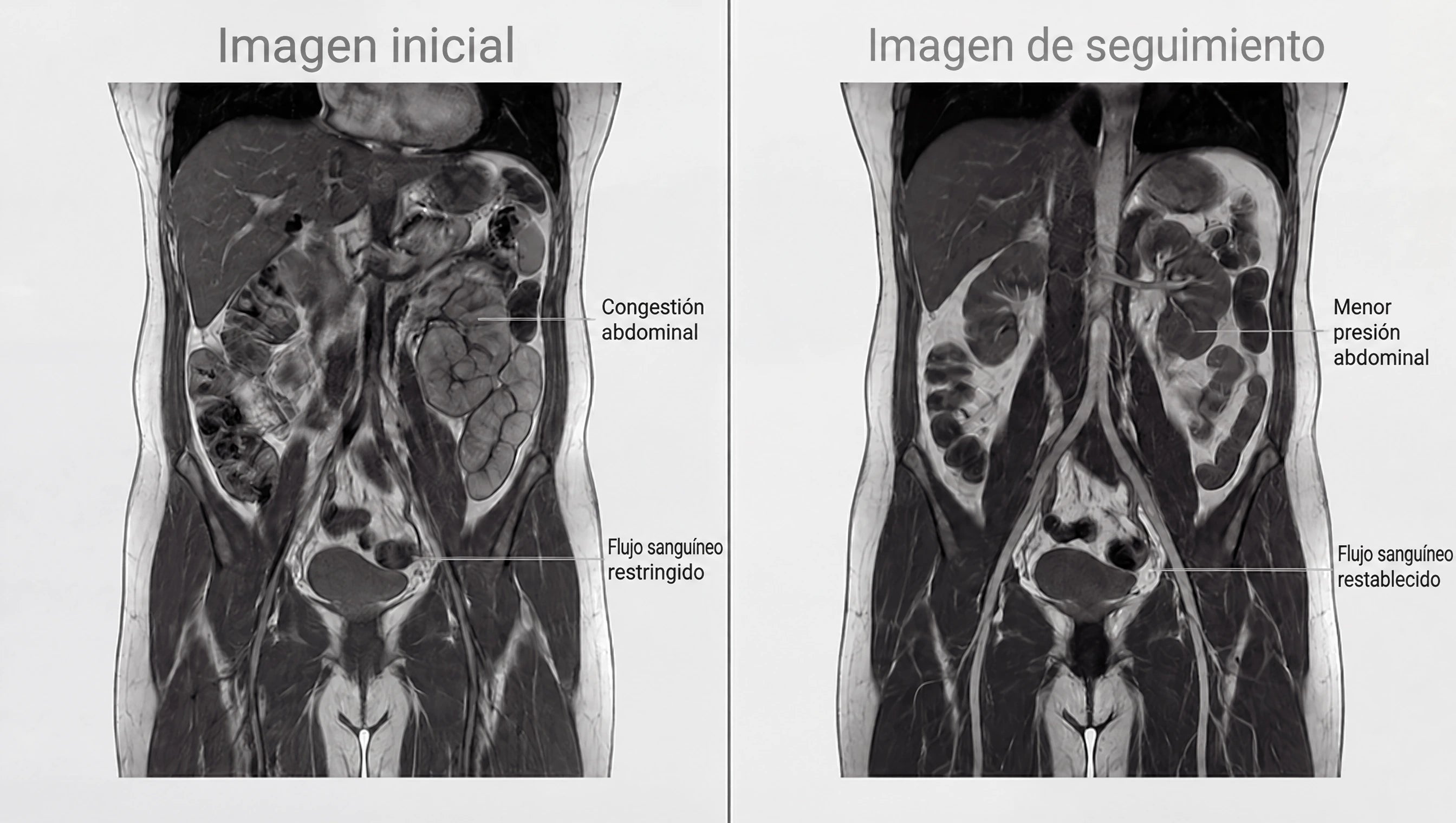 Imágenes médicas inicial y de seguimiento del artículo original