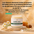 Mella Skin – Crema Para El Eccema