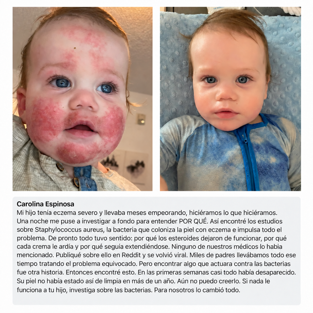 Mella Skin – Crema Para El Eccema
