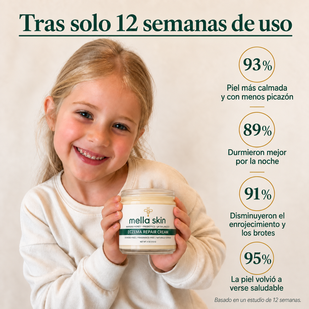 Mella Skin – Crema Para El Eccema
