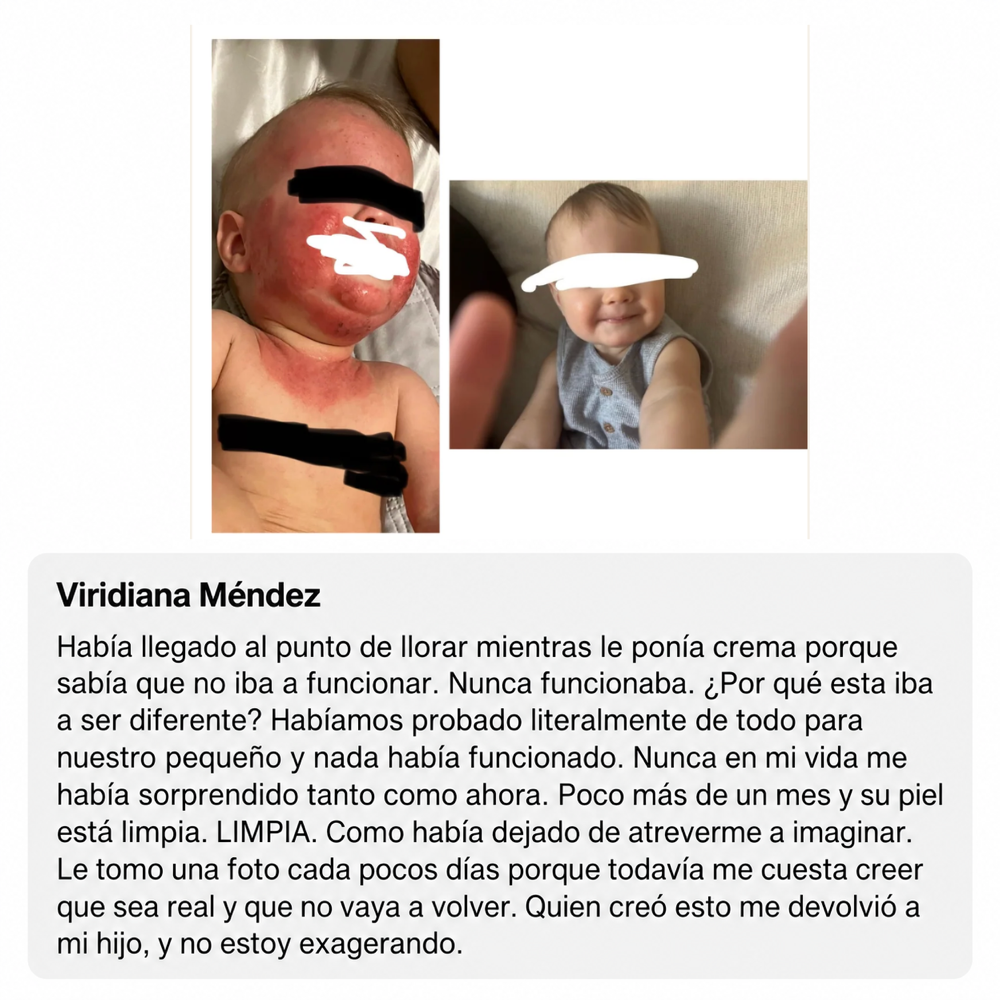 Mella Skin – Crema Para El Eccema