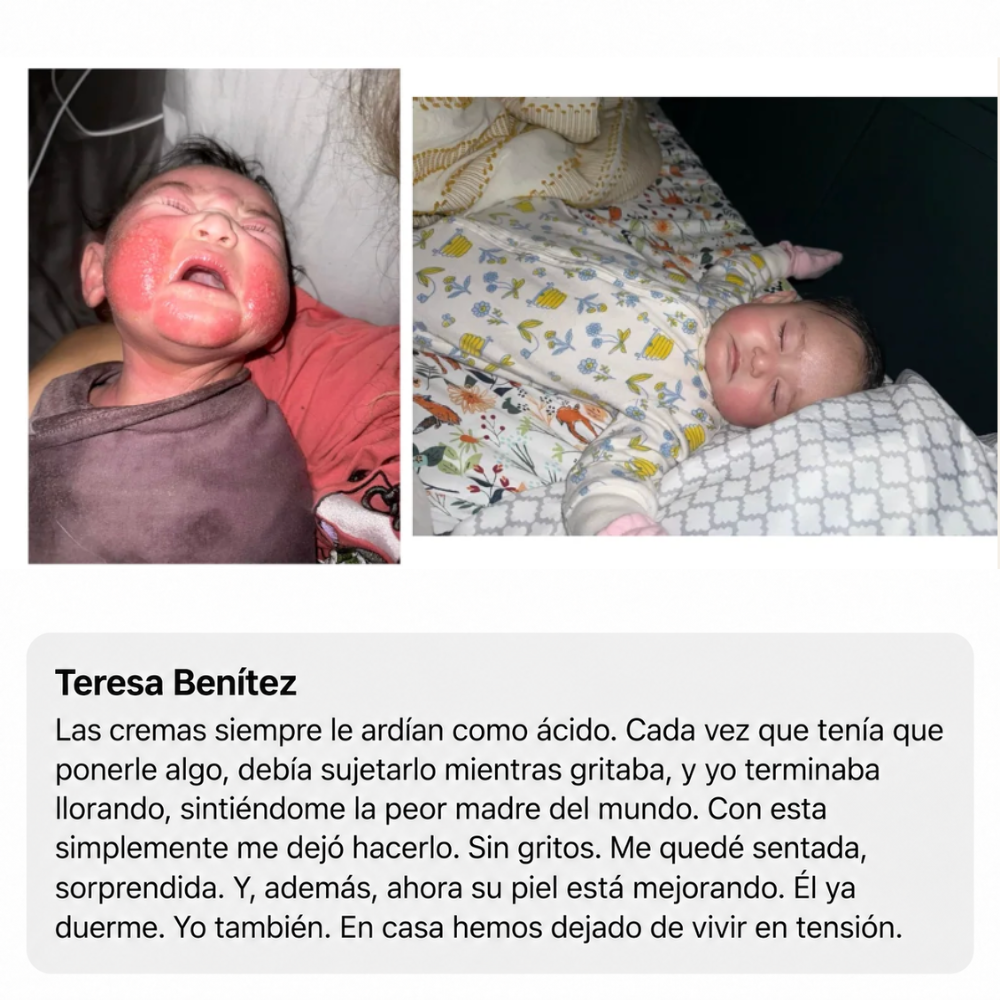 Mella Skin – Crema Para El Eccema