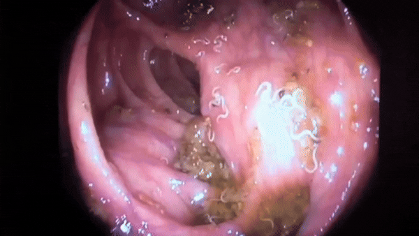 Animación intestinal del artículo original